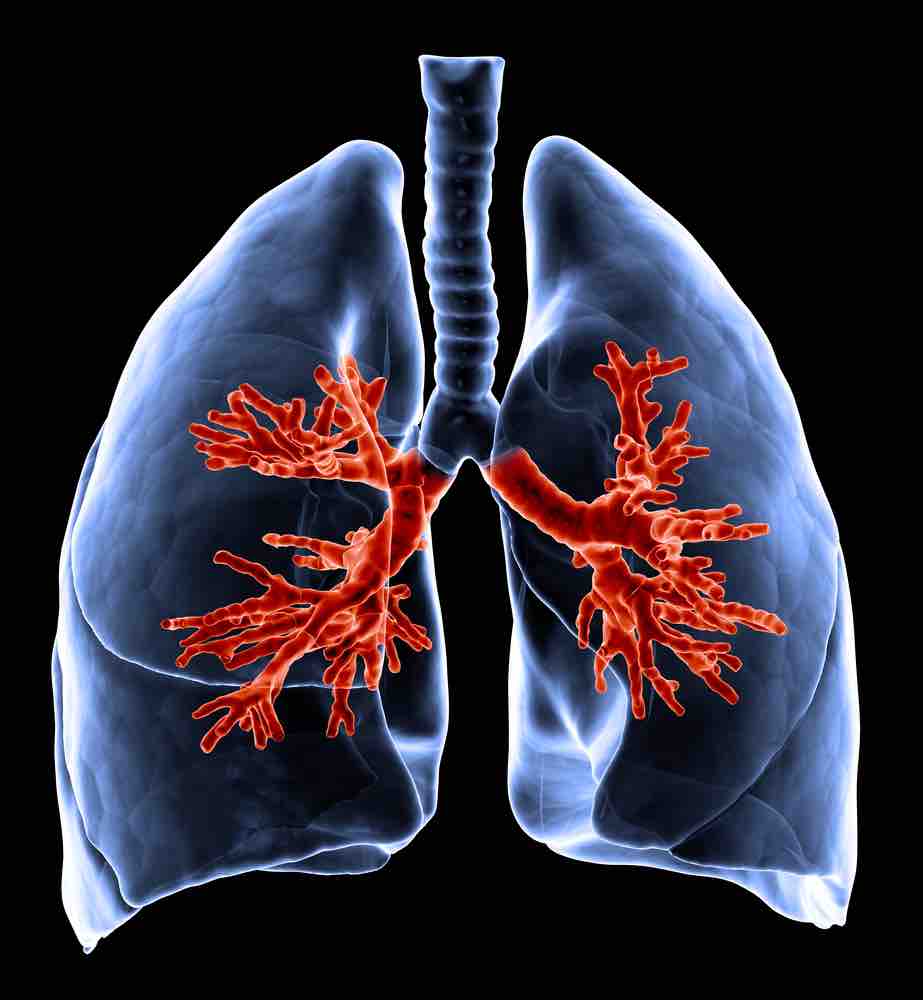 Bronquios en el interior de los pulmones