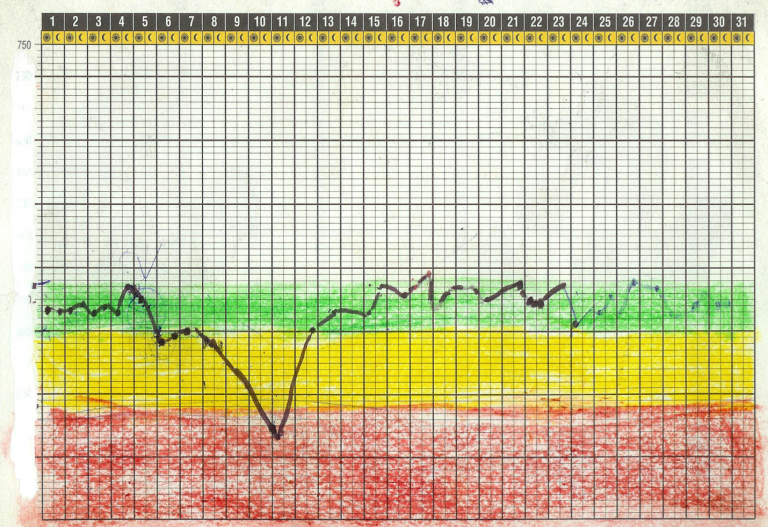 Grafico de crisis de asma registrada con el medidor de peak flow