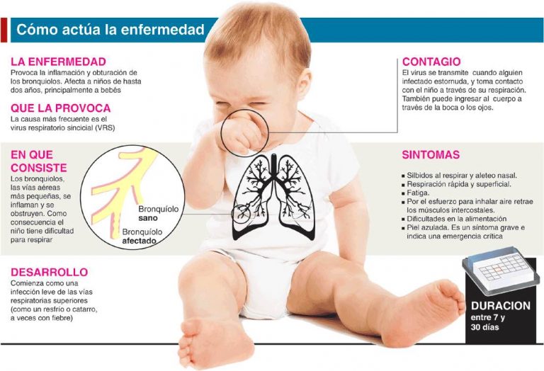 Bronquiolitis en bebés