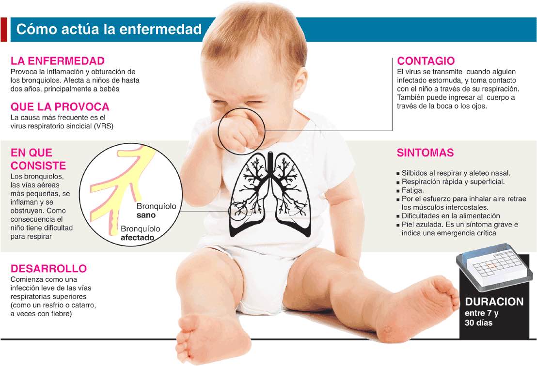Lee más sobre el artículo Bronquiolitis en bebés: un reto