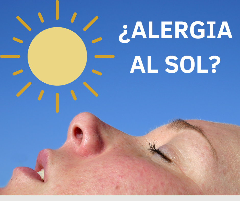 Lee más sobre el artículo ¿Alergia al sol?